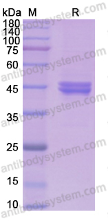 Recombinant Human NEU1/Sialidase-1 Protein, C-His