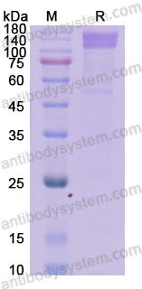 Recombinant Human OSMR/IL-31RB Protein, C-His