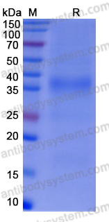 Recombinant Human CD158d/KIR2DL4 Protein, C-His