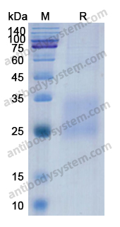 Recombinant Human SOST Protein, C-His