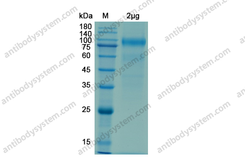 Recombinant Human ACE2 Protein, C-His