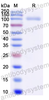 Recombinant Human ACE2 Protein, C-His