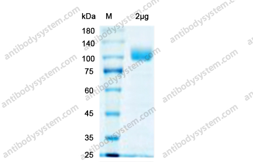 Recombinant Human ACE2 Protein, C-His