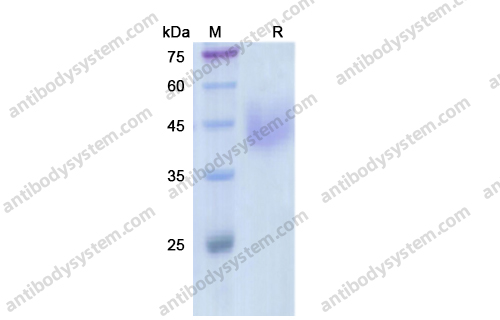 Recombinant Human CD360/IL21R Protein, C-His