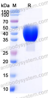 Recombinant Human CD320 Protein, C-His