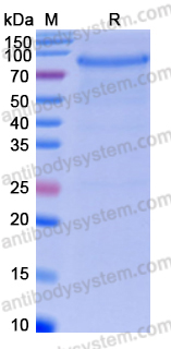 Recombinant Human CD93/C1qR Protein, C-His