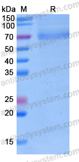 Recombinant Human DLL4 Protein, C-His