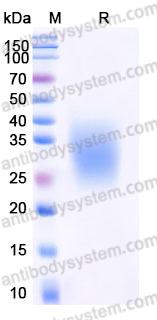 Recombinant Human TREM2 Protein, C-His