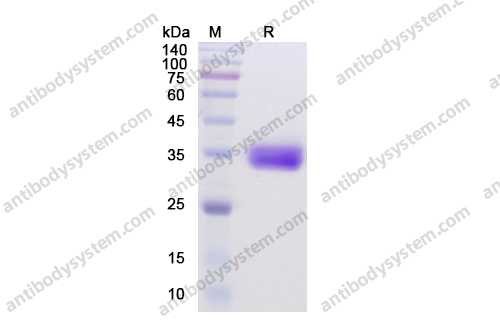 Recombinant Human CD274/PD-L1/B7-H1 Protein, C-His