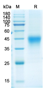 Recombinant Human CD84 Protein, C-His