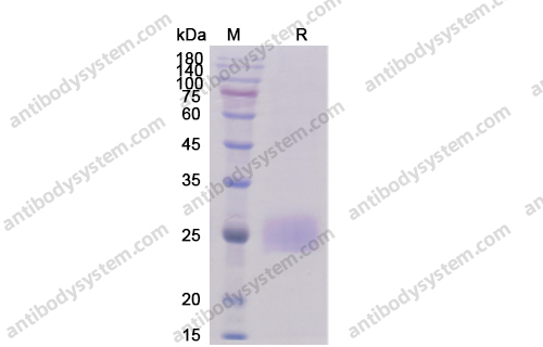 Recombinant Human CD344/FZD4 Protein, C-His