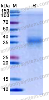 Recombinant Human CD201/PROCR Protein, C-His