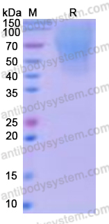 Recombinant Human CD208/LAMP3 Protein, C-His