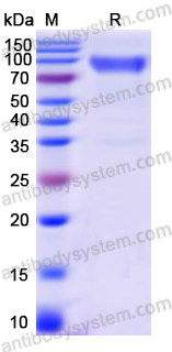 Recombinant Human CD328/SIGLEC7 Protein, C-Fc