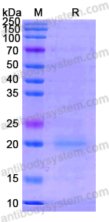 Recombinant Human CD350/FZD10 Protein, C-His