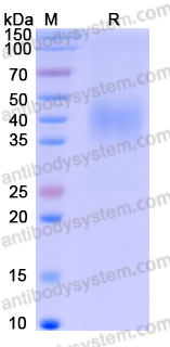 Recombinant Human CD371/CLEC12A Protein, C-His