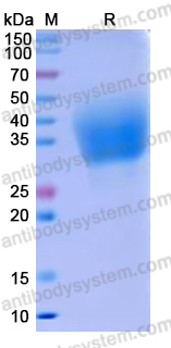 Recombinant Human CD89/FCAR Protein, C-His