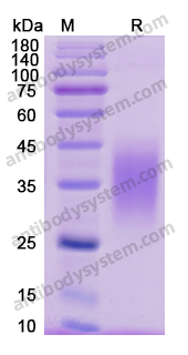 Recombinant Human VSIR/VISTA Protein, C-His