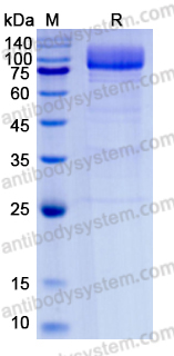 Recombinant Human SCARB1/SR-BI/CLA-1/SRB1 Protein, C-Fc