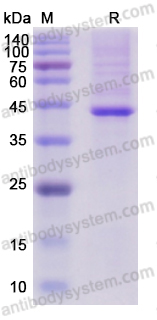 Recombinant Human MYOM3/Myomesin-3 Protein, N-His