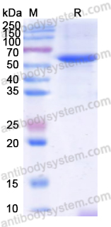 Recombinant Human FTO Protein, C-His
