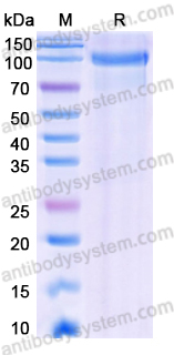 Recombinant Human LRP12/ST7 Protein, C-Fc