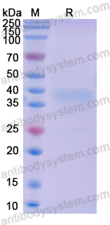 Recombinant Mouse LAYN/Layilin Protein, C-His