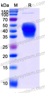 Recombinant Mouse CSF1/M-CSF Protein, C-His