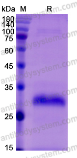 Recombinant Mouse MBL2/MBP-C Protein, C-His