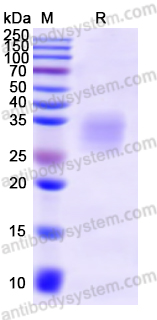 Recombinant Mouse CCL2/MCP-1 Protein, C-His