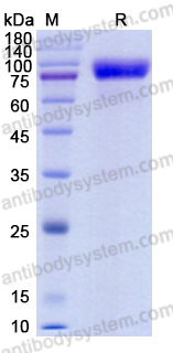 Recombinant Mouse CD121a/IL1R1 Protein, C-Fc