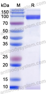 Recombinant Mouse MMP9 Protein, C-His