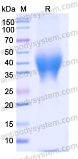 Recombinant Mouse LIF Protein, C-His