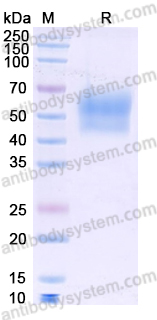 Recombinant Mouse CD121b/IL1R2 Protein, C-His