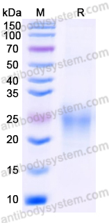 Recombinant Mouse ACVRL1 Protein, C-His