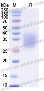 Recombinant Mouse CD47/IAP Protein, C-His