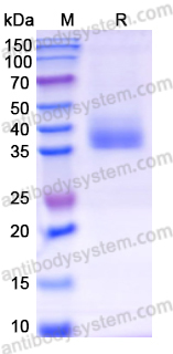 Recombinant Mouse CD157/BST1 Protein, C-His