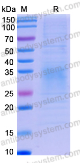 Recombinant Mouse CD279/PDCD1/PD1 Protein, C-His