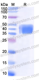 Recombinant Mouse CD226/DNAM-1 Protein, C-His