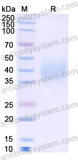 Recombinant Mouse CD360/IL21R Protein, C-His