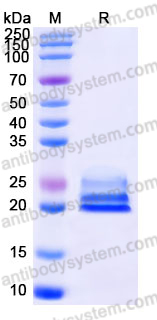 Recombinant Mouse FGF21 Protein, C-His
