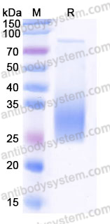 Recombinant Mouse TREM2 Protein, C-His