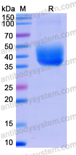 Recombinant Mouse CD274/PD-L1/B7-H1 Protein, C-His