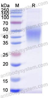 Recombinant Dog CD124/IL4R/IL-4Rα Protein, C-His