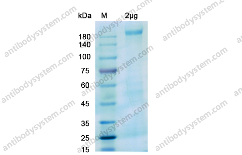 Recombinant SARS-CoV-2 S - Trimer (RRAR-GSAS Protein, KV-PP), C-His