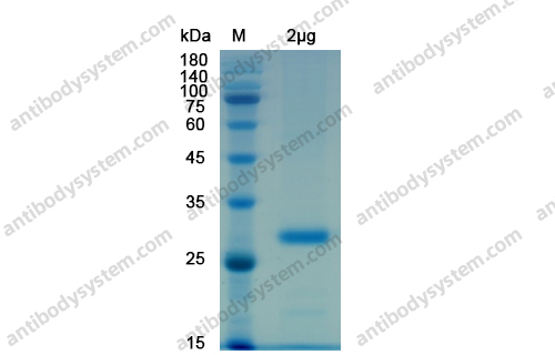 Recombinant SARS-CoV-2 RBD Protein, C-His