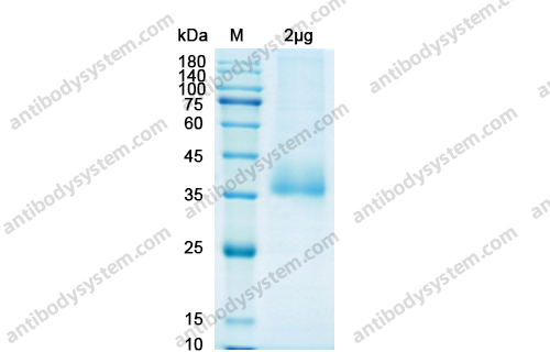 Recombinant SARS-CoV-2 RBD Protein, C-His-Avi