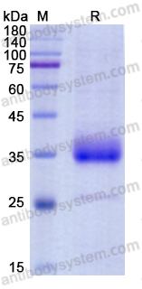 Recombinant SARS-CoV-2 RBD (E484K) Protein, C-His