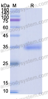 Recombinant SARS-CoV-2 RBD (B.1.1.7) Protein, C-His