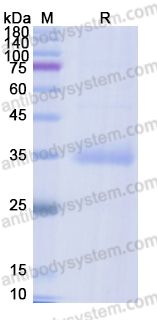 Recombinant SARS-CoV-2 RBD (B.1.351) Protein, C-His